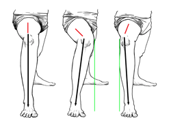 Precise alignment versus alignment accuracy