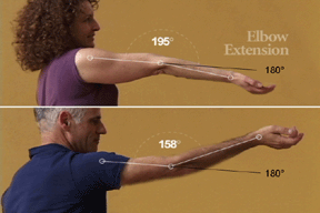 newsletter16_elbow_extensio.gif